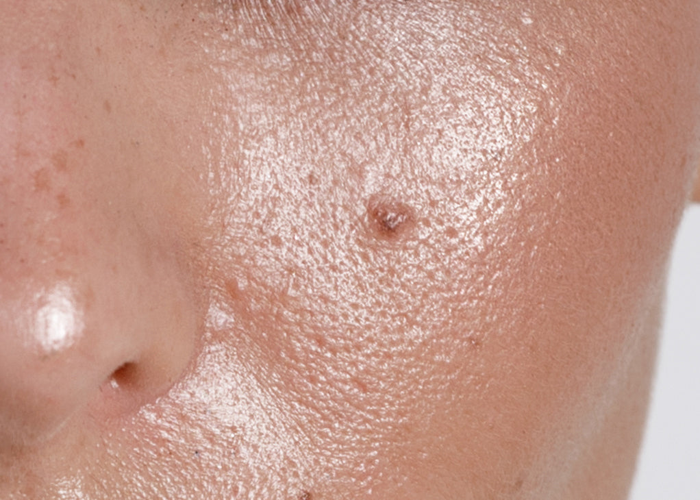 Face Texture Problems How to Solve Skin Texture Troubles
